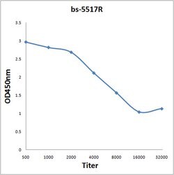 Phospho-IKB epsilon (Ser157) Rabbit anti-Human, Polyclonal, Bioss 100 &mu;L;