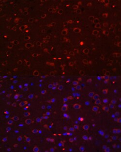 STAT3 Polyclonal Antibody, Bioss 100 &mu;L; Unconjugated:Antibodies, Polyclonal