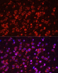 STAT3 Polyclonal Antibody, Bioss 100 &mu;L; Unconjugated:Antibodies, Polyclonal