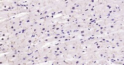 STAT3 Polyclonal Antibody, Bioss 100 &mu;L; Unconjugated:Antibodies, Polyclonal