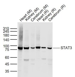 STAT3 Polyclonal Antibody, Bioss 100 &mu;L; Unconjugated:Antibodies, Polyclonal