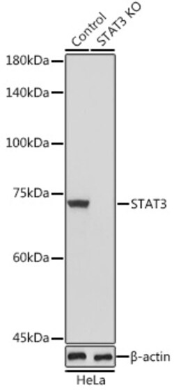 STAT3 Polyclonal Antibody, Bioss 100 &mu;L; Unconjugated:Antibodies, Polyclonal