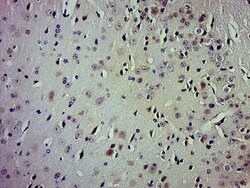 Phospho-TrkA/B/C (Tyr496, Tyr516, Tyr516) Rabbit anti-Human Mouse, Polyclonal,