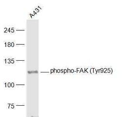 Phospho-FAK (Tyr925) Rabbit anti-Human, Polyclonal, Bioss 100 &mu;L; Unconjugated:Antibodies,
