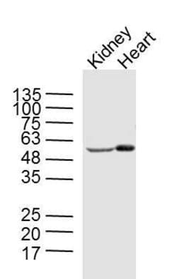 Phospho-AMPK alpha 2 (Ser173) Rabbit anti-Human, Polyclonal, Bioss 100