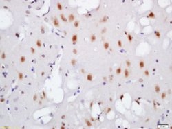 Phospho-TNIK (Ser764) Rabbit anti-Human, Polyclonal, Bioss 100 &mu;L; Unconjugated:Antibodies,
