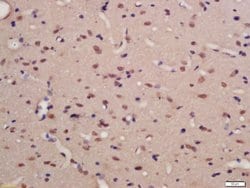 Phospho-TNIK (Ser769) Rabbit anti-Human, Polyclonal, Bioss 100 &mu;L; Unconjugated:Antibodies,