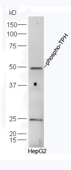Phospho-TPH (Ser260) Rabbit anti-Human, Polyclonal, Bioss 100 &mu;L; Unconjugated:Antibodies,
