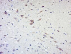 Phospho-RPS6KB1 (Ser441, Thr444) Rabbit anti-Human Mouse Rat, Polyclonal,