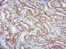Phospho-RPS6KB1 (Ser441, Thr444) Rabbit anti-Human Mouse Rat, Polyclonal,
