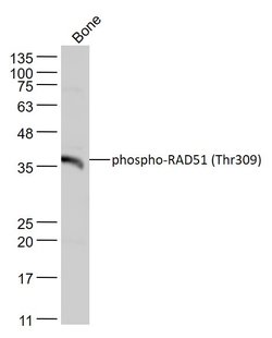 Phospho-RAD51 (Thr309) Rabbit anti-Human, Polyclonal, Bioss 100 &mu;L;