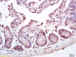 ZNF693 Rabbit anti-Human, Polyclonal, Bioss 100 &mu;L; Unconjugated:Antibodies,