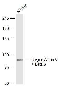 Integrin Alpha V + Beta 6 Rabbit anti-Human Mouse Rat, Polyclonal, Bioss 100 &mu;L | Buy Online | Bioss | Fisher Scientific