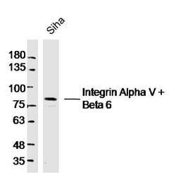 Integrin Alpha V + Beta 6 Rabbit anti-Human Mouse Rat, Polyclonal, Bioss 100 &mu;L | Buy Online | Bioss | Fisher Scientific