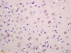 RAB21 Rabbit anti-Human, Polyclonal, Bioss 100 &mu;L; Unconjugated:Antibodies,