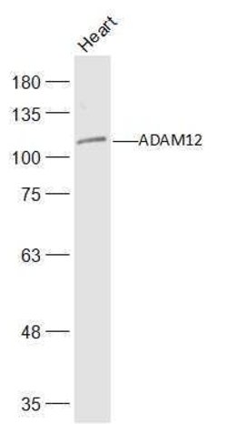 ADAM12 Rabbit anti-Human, Polyclonal, Bioss 100 &mu;L; Unconjugated:Antibodies,