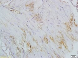 CTHRC1 Rabbit anti-Human, Polyclonal, Bioss 100 &mu;L; Unconjugated:Antibodies,