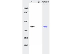 CTHRC1 Rabbit anti-Human, Polyclonal, Bioss 100 &mu;L; Unconjugated:Antibodies,