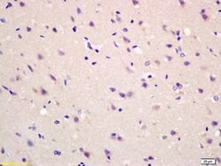 MAS1L Rabbit anti-Human, Polyclonal, Bioss 100 &mu;L; Unconjugated:Antibodies,