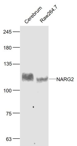 NARG2 Rabbit anti-Human, Polyclonal, Bioss 100 &mu;L; Unconjugated:Antibodies,
