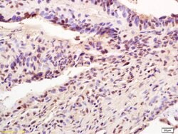 AIM2 Rabbit anti-Human, Polyclonal, Bioss 100 &mu;L; Unconjugated:Antibodies,
