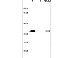HSP40 homolog Rabbit anti-Human, Polyclonal, Bioss 100 &mu;L; Unconjugated:Antibodies,