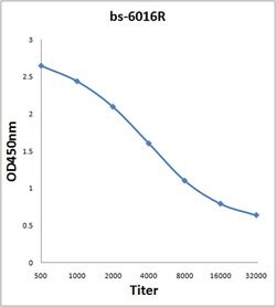 RBBP5 Rabbit anti-Human, Polyclonal, Bioss 100 &mu;L; Unconjugated:Antibodies,