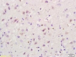 RBBP5 Rabbit anti-Human, Polyclonal, Bioss 100 &mu;L; Unconjugated:Antibodies,
