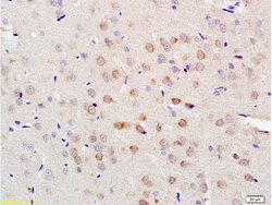 LLGL1 Rabbit anti-Human, Polyclonal, Bioss 100 &mu;L; Unconjugated:Antibodies,