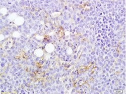 MTUS1 Rabbit anti-Human, Polyclonal, Bioss 100 &mu;L; Unconjugated:Antibodies,