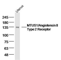 MTUS1 Rabbit anti-Human, Polyclonal, Bioss 100 &mu;L; Unconjugated:Antibodies,