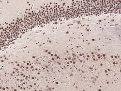 PHAP Rabbit anti-Human, Polyclonal, Bioss 100 &mu;L; Unconjugated:Antibodies,