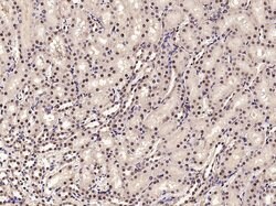 PHAP Rabbit anti-Human, Polyclonal, Bioss 100 &mu;L; Unconjugated:Antibodies,