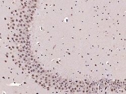 PHAP Rabbit anti-Human, Polyclonal, Bioss 100 &mu;L; Unconjugated:Antibodies,