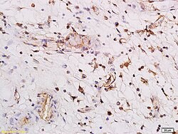 Rho GTPase activating protein 29 Rabbit anti-Human, Polyclonal, Bioss 100