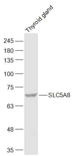 SLC5A8 Rabbit anti-Human, Polyclonal, Bioss 100 &mu;L; Unconjugated:Antibodies,