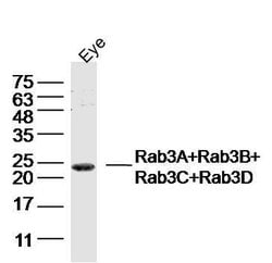 Rab3A+Rab3B+Rab3C+Rab3D Rabbit anti-Human Mouse Rat, Polyclonal, Bioss 100 &mu;L | Buy Online | Bioss | Fisher Scientific