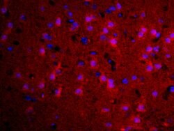 TGM2 Rabbit anti-Human, Polyclonal, Bioss 100 &mu;L; Unconjugated:Antibodies,
