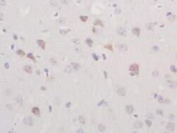 TGM2 Rabbit anti-Human, Polyclonal, Bioss 100 &mu;L; Unconjugated:Antibodies,