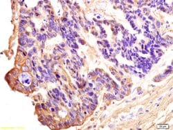 CT13 Rabbit anti-Human, Polyclonal, Bioss 100 &mu;L; Unconjugated:Antibodies,