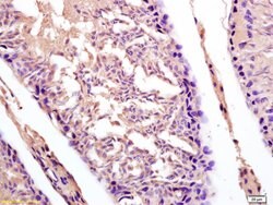 CT13 Rabbit anti-Human, Polyclonal, Bioss 100 &mu;L; Unconjugated:Antibodies,