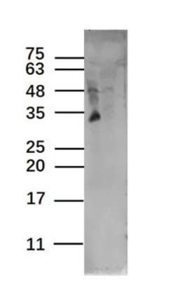 TAAL6 Rabbit anti-Human, Polyclonal, Bioss 100 &mu;L | Buy Online | Bioss | Fisher Scientific