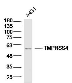 TMPRSS4 Rabbit anti-Human, Polyclonal, Bioss 100 μL; Unconjugated:Antibodies,