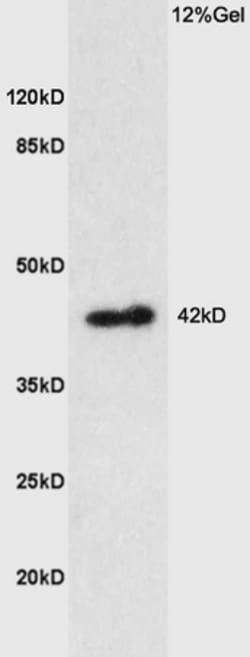 PTGER1 Rabbit anti-Human, Polyclonal, Bioss 100 &mu;L; Unconjugated:Antibodies,
