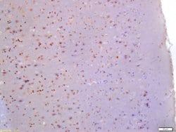 Glutamine PRPP amidotransferase Rabbit anti-Human, Polyclonal, Bioss 100