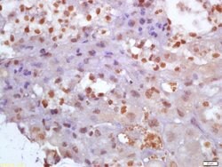 Glutamine PRPP amidotransferase Rabbit anti-Human, Polyclonal, Bioss 100