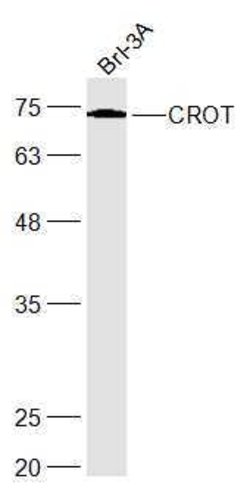 CROT Rabbit anti-Human, Polyclonal, Bioss 100 &mu;L | Buy Online | Bioss | Fisher Scientific