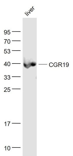 CGR19 Rabbit anti-Human, Polyclonal, Bioss 100 &mu;L; Unconjugated:Antibodies,