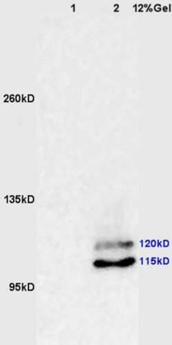 Phospho-PI3 Kinase p110 beta (Ser1070) Rabbit anti-Human, Polyclonal, Bioss