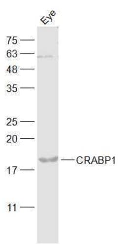 Retinol Binding Protein Rabbit anti-Human, Polyclonal, Bioss 100 &mu;L | Buy Online | Bioss | Fisher Scientific